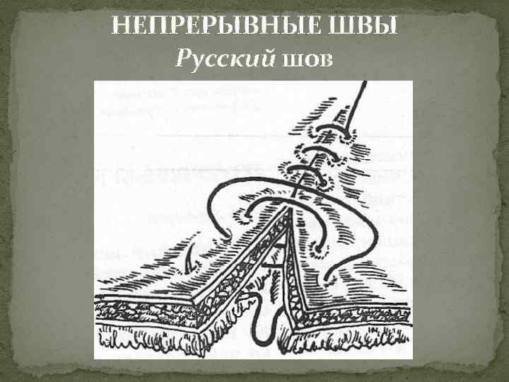 НЕПРЕРЫВНЫЕ ШВЫ Русский шов 