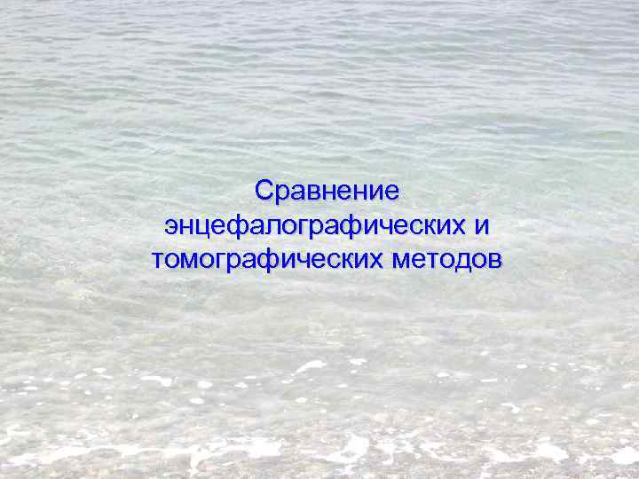 Сравнение энцефалографических и томографических методов 