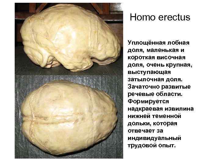 Homo erectus Уплощённая лобная доля, маленькая и короткая височная доля, очень крупная, выступающая затылочная