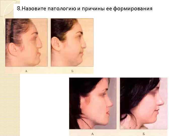 8. Назовите патологию и причины ее формирования 