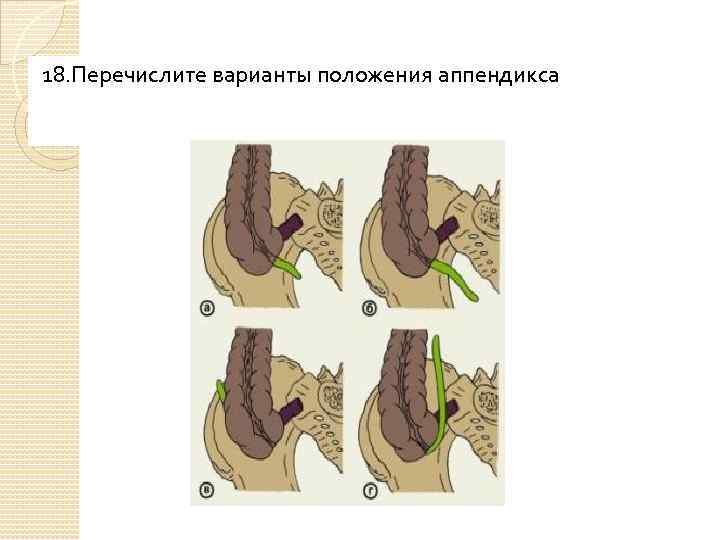 18. Перечислите варианты положения аппендикса 