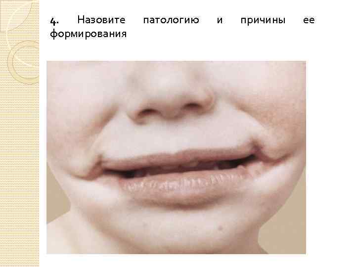 4. Назовите формирования патологию и причины ее 