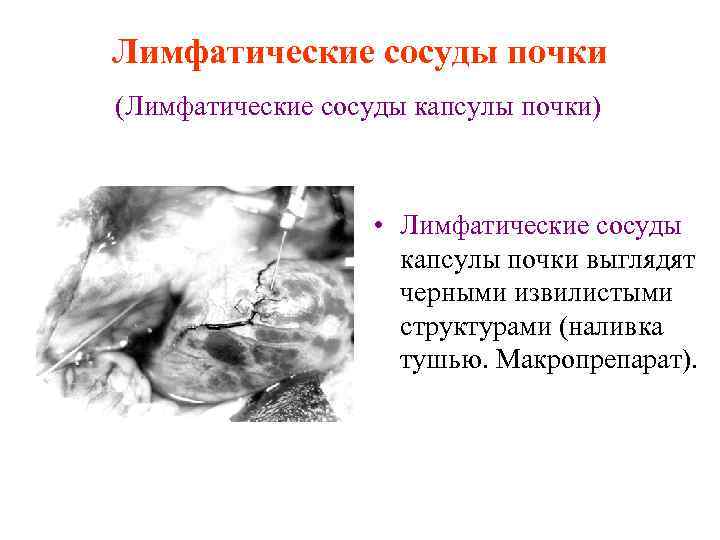 Лимфатические сосуды почки (Лимфатические сосуды капсулы почки) • Лимфатические сосуды капсулы почки выглядят черными