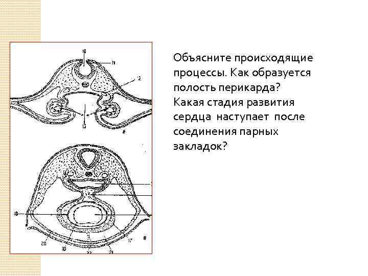Объясните происходящие процессы. Как образуется полость перикарда? Какая стадия развития сердца наступает после соединения