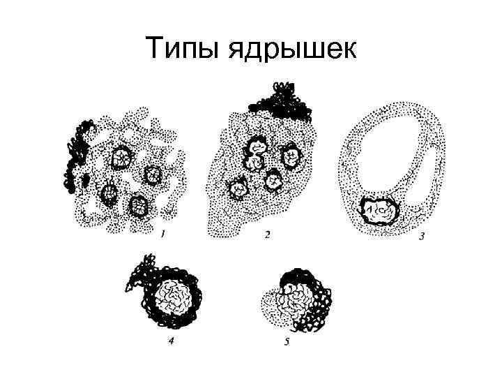 Типы ядрышек 