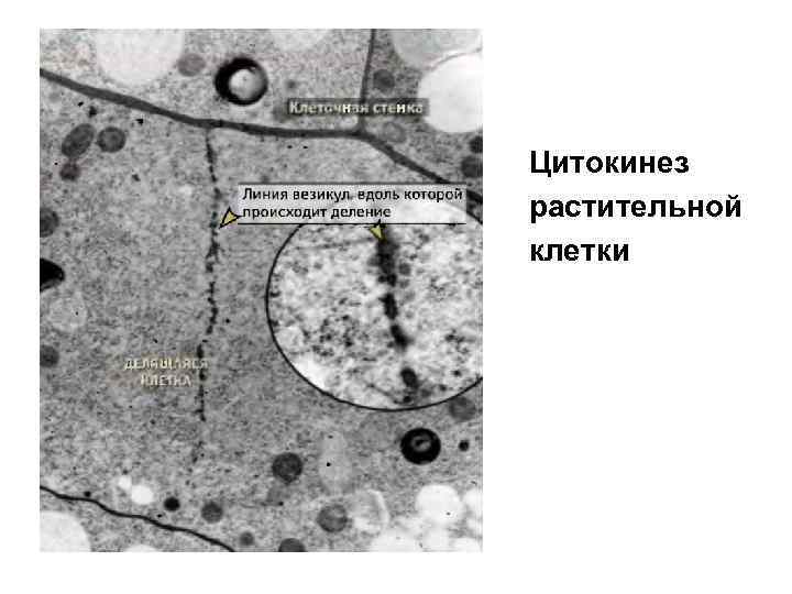 Цитокинез растительной клетки 