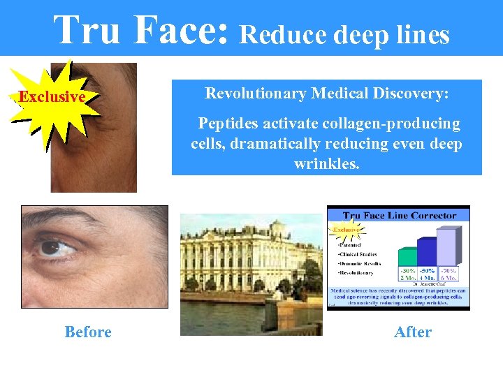 Tru Face: Reduce deep lines Exclusive Revolutionary Medical Discovery: Peptides activate collagen-producing cells, dramatically