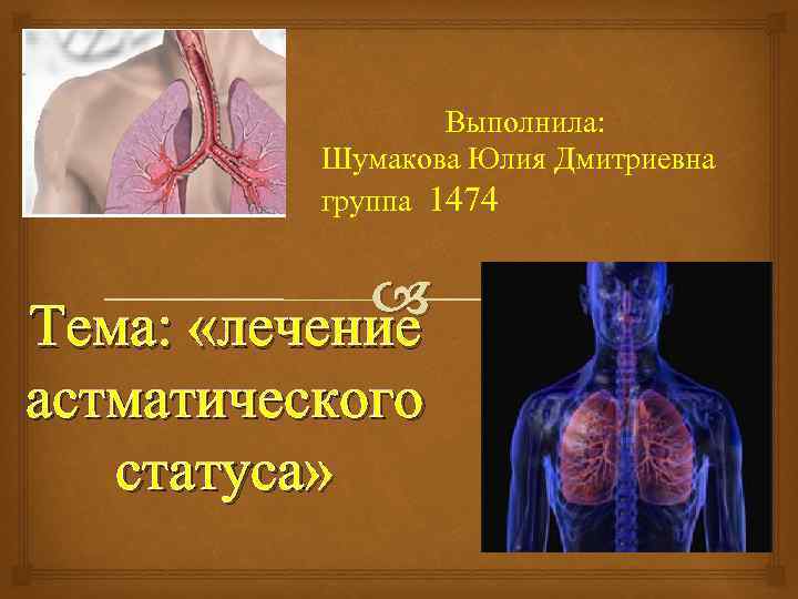 Выполнила: Шумакова Юлия Дмитриевна группа 1474 Тема: «лечение астматического статуса» 