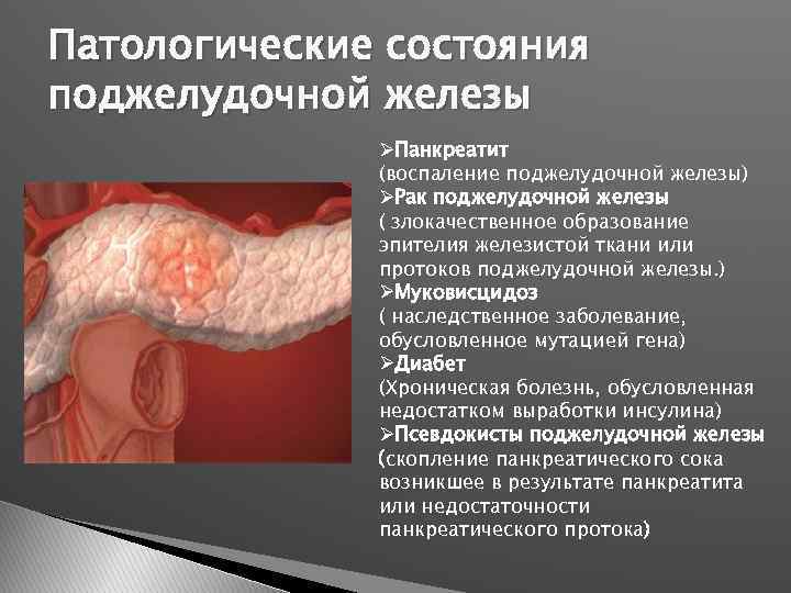 Патологические состояния поджелудочной железы ØПанкреатит (воспаление поджелудочной железы) ØРак поджелудочной железы ( злокачественное образование