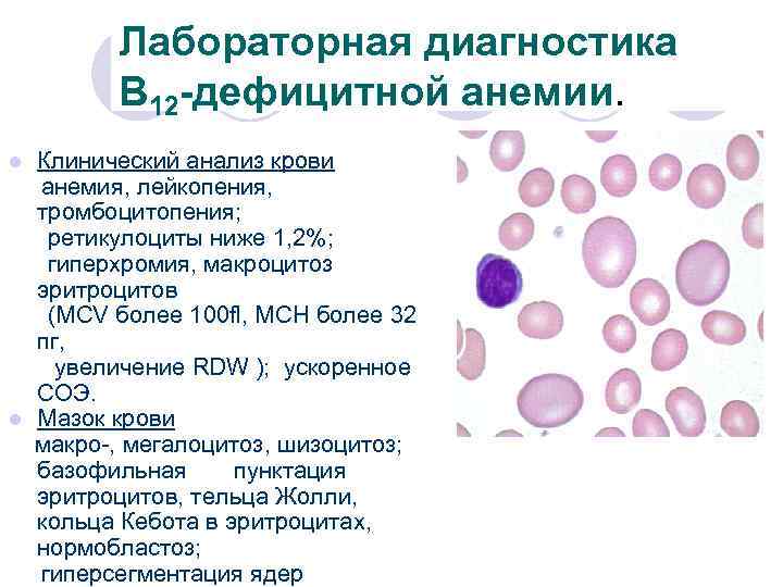 Картина крови при в12 и фолиеводефицитной анемии