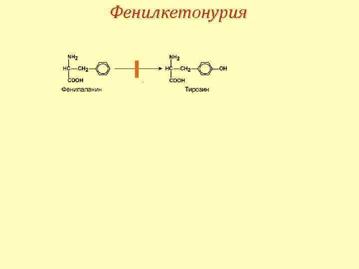 Фенилкетонурия 