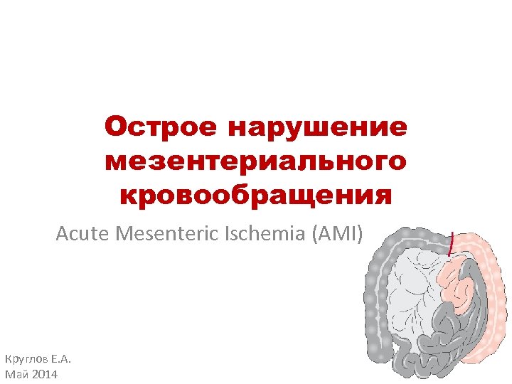 Острое нарушение мезентериального кровообращения Acute Mesenteric Ischemia (AMI) Круглов Е. А. Май 2014 
