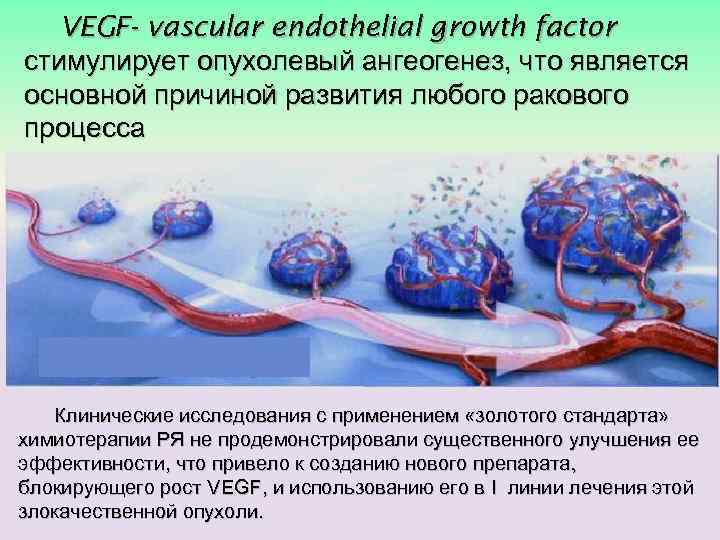 VEGF- vascular endothelial growth factor стимулирует опухолевый ангеогенез, что является основной причиной развития любого