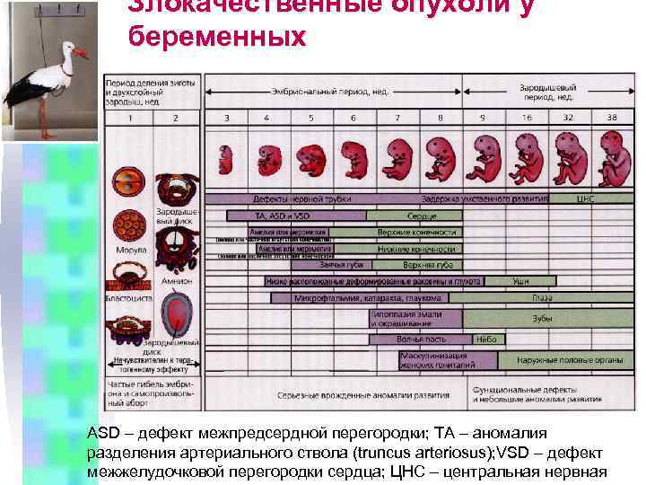 Злокачественные опухоли у беременных ASD – дефект межпредсердной перегородки; ТА – аномалия разделения артериального