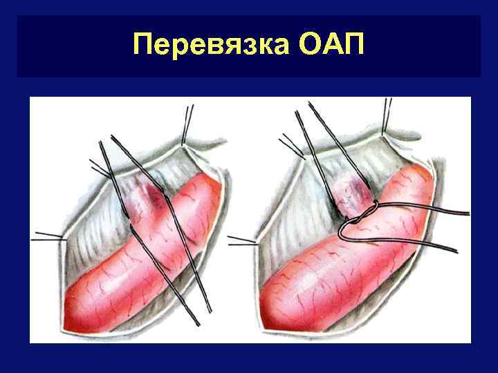 Врожденные и приобретенные пороки сердца презентация