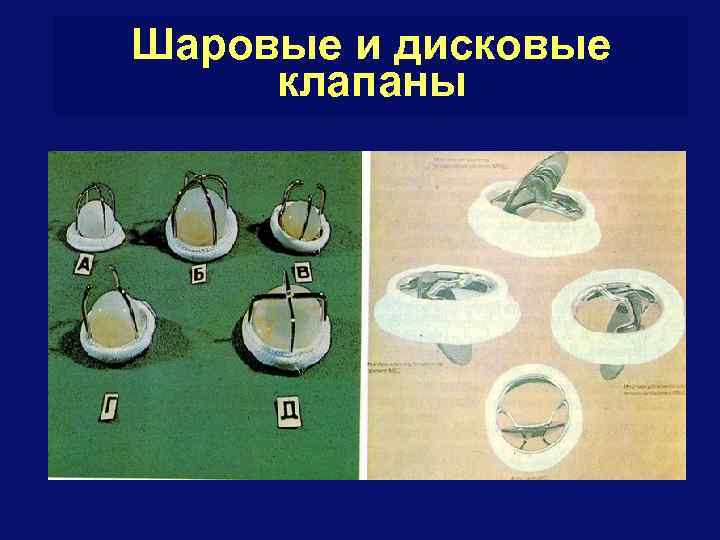 Шаровые и дисковые клапаны 