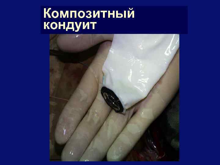 Композитный кондуит 