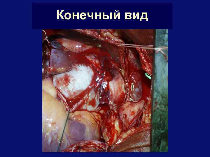 Конечный вид 