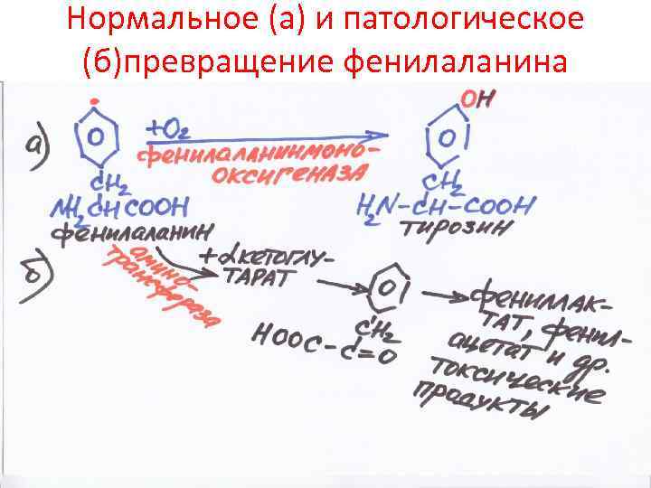 Нормальное (а) и патологическое (б)превращение фенилаланина 