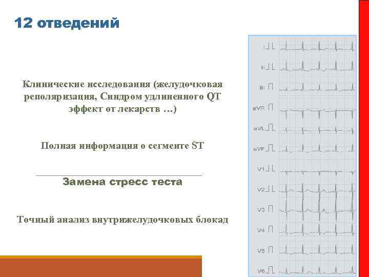 12 отведений Клинические исследования (желудочковая реполяризация, Синдром удлиненного QT эффект от лекарств …) Полная