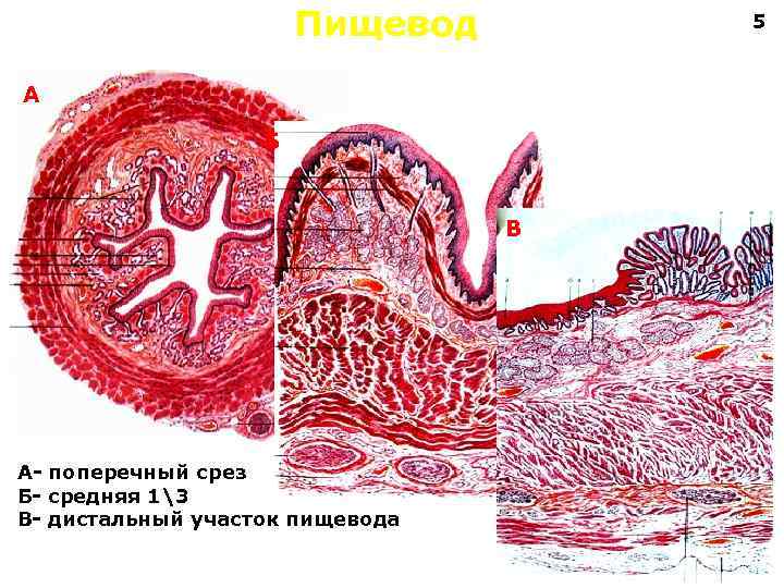 Пищевод 5 А Б В А- поперечный срез Б- средняя 13 В- дистальный участок