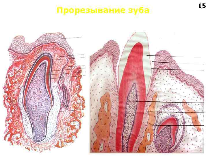 Прорезывание верхних зубов фото