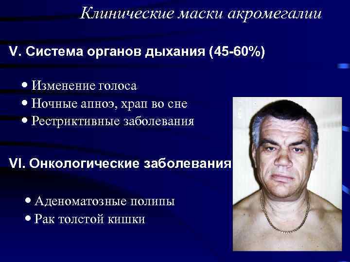 Клинические маски акромегалии V. Система органов дыхания (45 -60%) Изменение голоса Ночные апноэ, храп