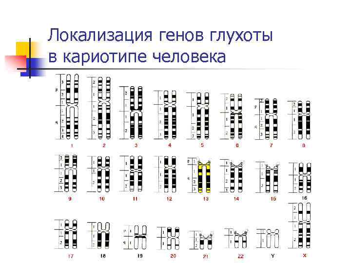 Локализация генов глухоты в кариотипе человека 