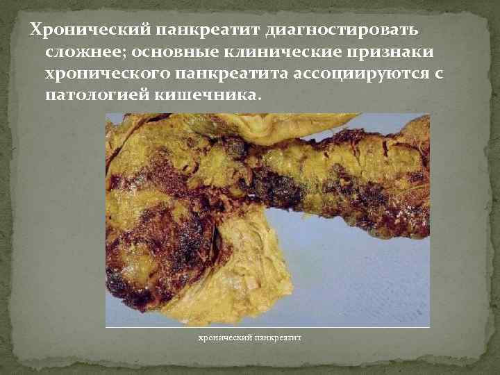 Хронический панкреатит диагностировать сложнее; основные клинические признаки хронического панкреатита ассоциируются с патологией кишечника. хронический