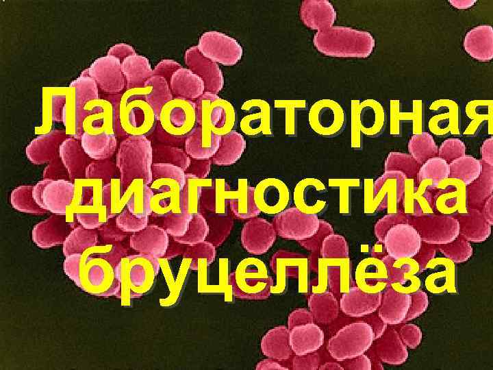 Лабораторная диагностика бруцеллёза 
