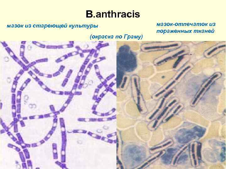 B. аnthracis мазок из стареющей культуры (окраска по Граму)) мазок-отпечаток из пораженных тканей 