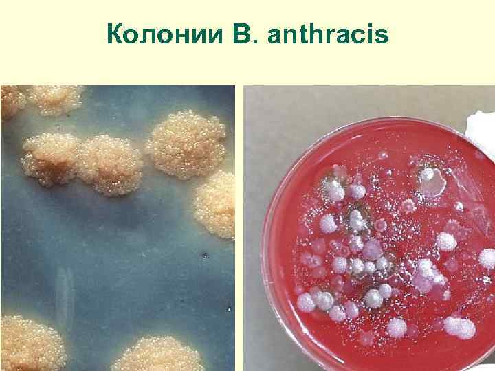 Колонии B. anthracis 