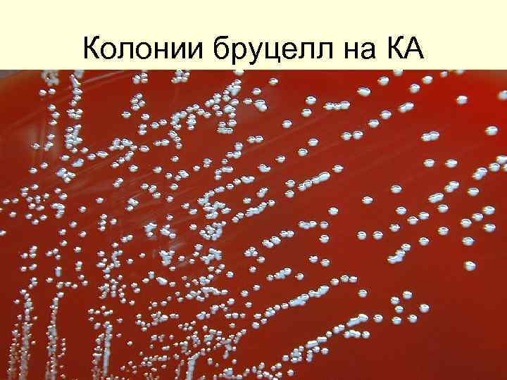 Колонии бруцелл на КА 