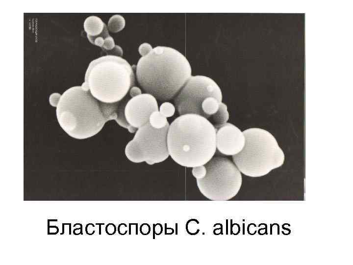 Бластоспоры C. albicans 