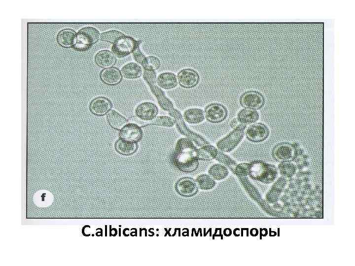 C. albicans: хламидоспоры 