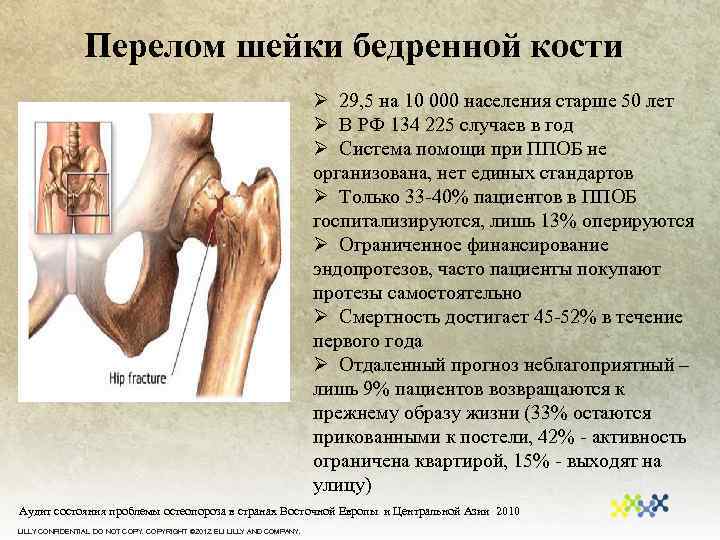 Закрытый перелом шейки бедра карта смп