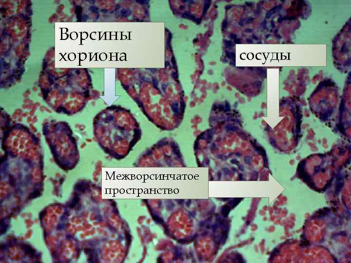 Ворсины хориона Межворсинчатое пространство сосуды 