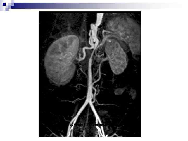 Andrews J , Mason J C Rheumatology 2007; 46: 6 -15 
