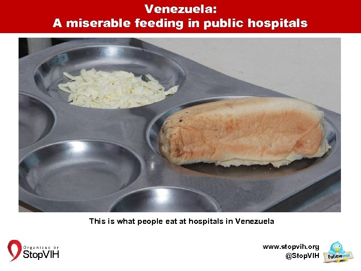 Venezuela: A miserable feeding in public hospitals This is what people eat at hospitals