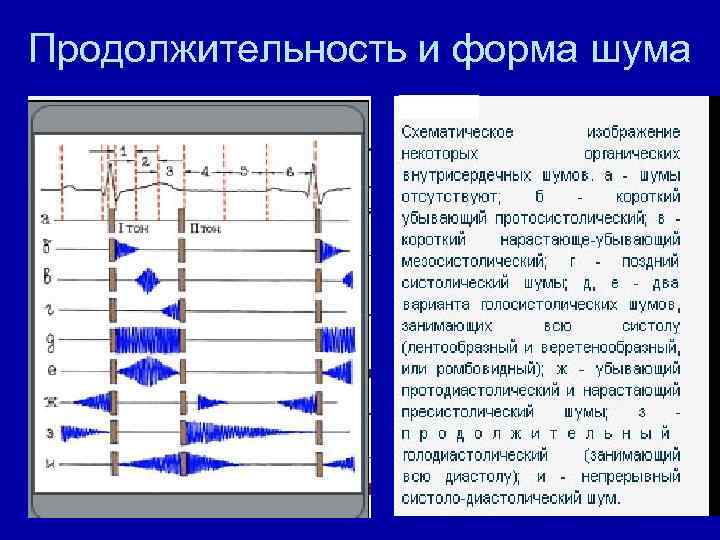 Продолжительность и форма шума 