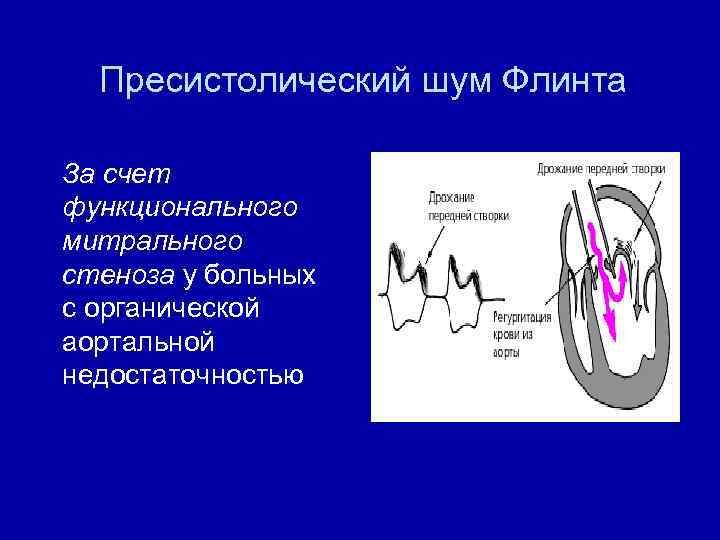 Шумы в сердце в 2 года