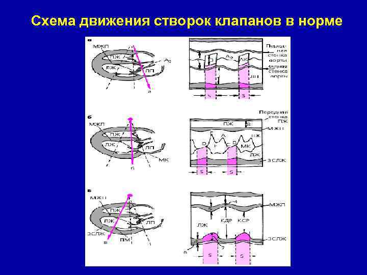 Схема движения створок клапанов в норме 