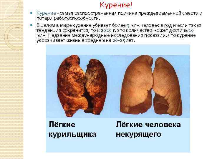 Курение! Курение - самая распространенная причина преждевременной смерти и потери работоспособности. В целом в