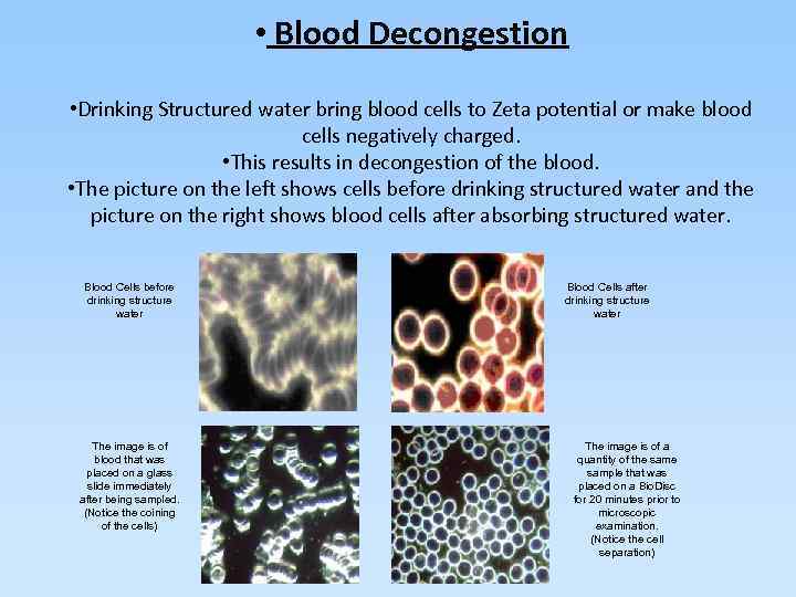  • Blood Decongestion • Drinking Structured water bring blood cells to Zeta potential