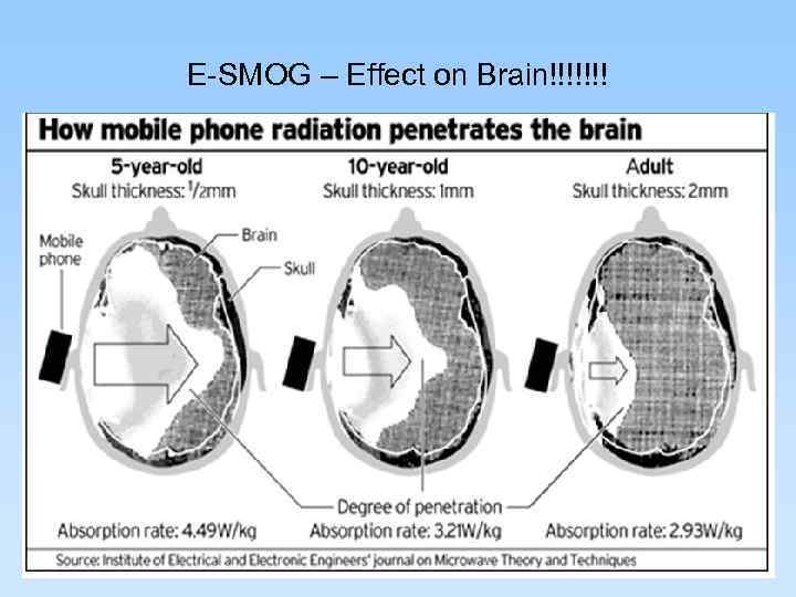 E-SMOG – Effect on Brain!!!!!!! 