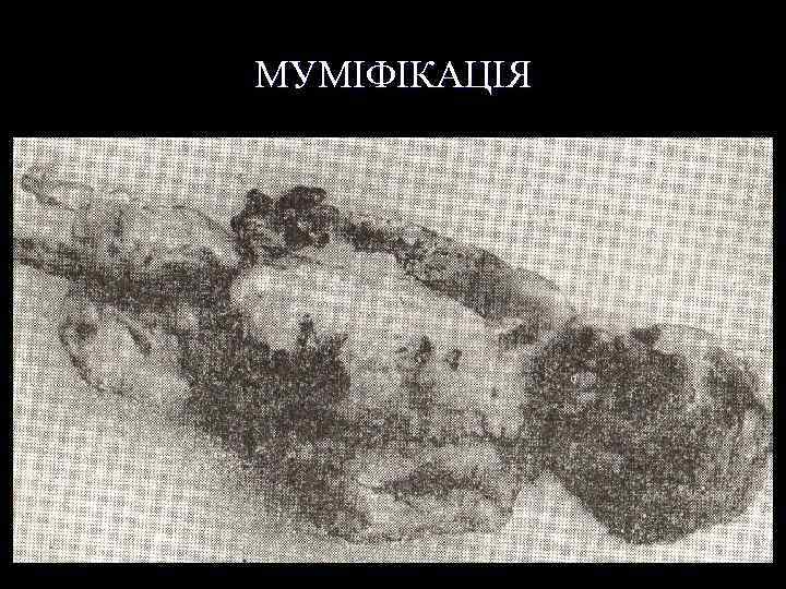 МУМІФІКАЦІЯ 