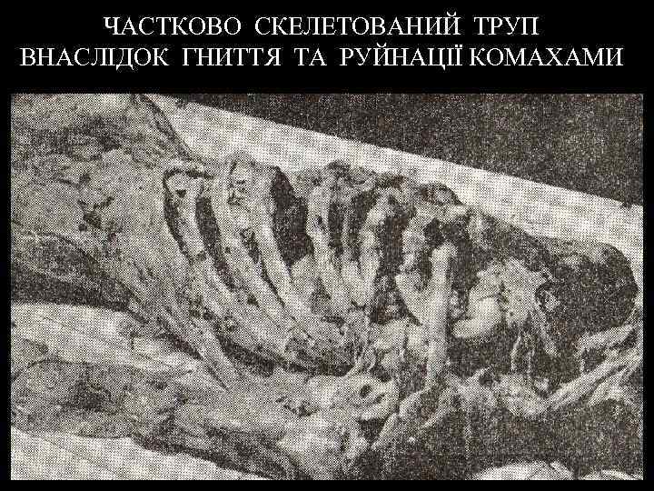 ЧАСТКОВО СКЕЛЕТОВАНИЙ ТРУП ВНАСЛІДОК ГНИТТЯ ТА РУЙНАЦІЇ КОМАХАМИ 