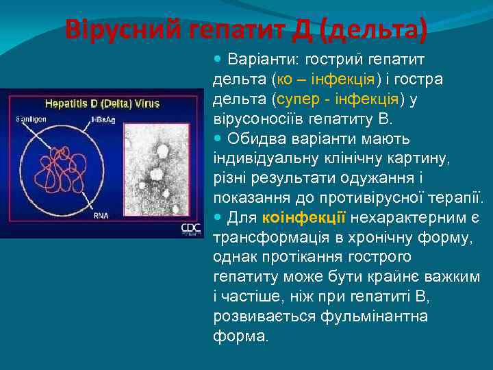 Вірусний гепатит Д (дельта) Варіанти: гострий гепатит дельта (ко – інфекція) і гостра дельта