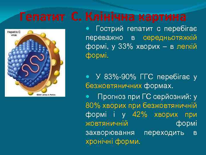 Гепатит С. Клінічна картина Гострий гепатит с перебігає переважно в середньотяжкій формі, у 33%