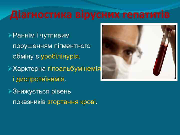 Діагностика вірусних гепатитів ØРаннім і чутливим порушенням пігментного обміну є уробілінурія. ØХарктерна гіпоальбумінемія і